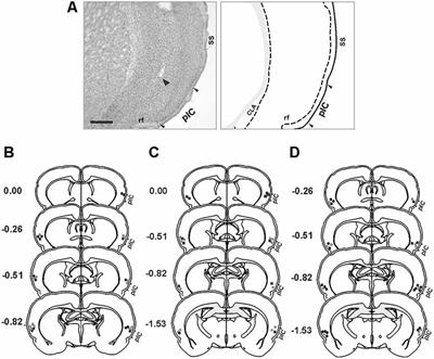 Interoceptive Insular Cortex Mediates Both Innate Fear and Contextual Threat Conditioning to Predator Odor